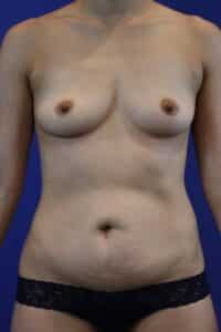 Before Image: Patient Case #3189