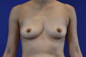 Before Image: Patient Case #3190