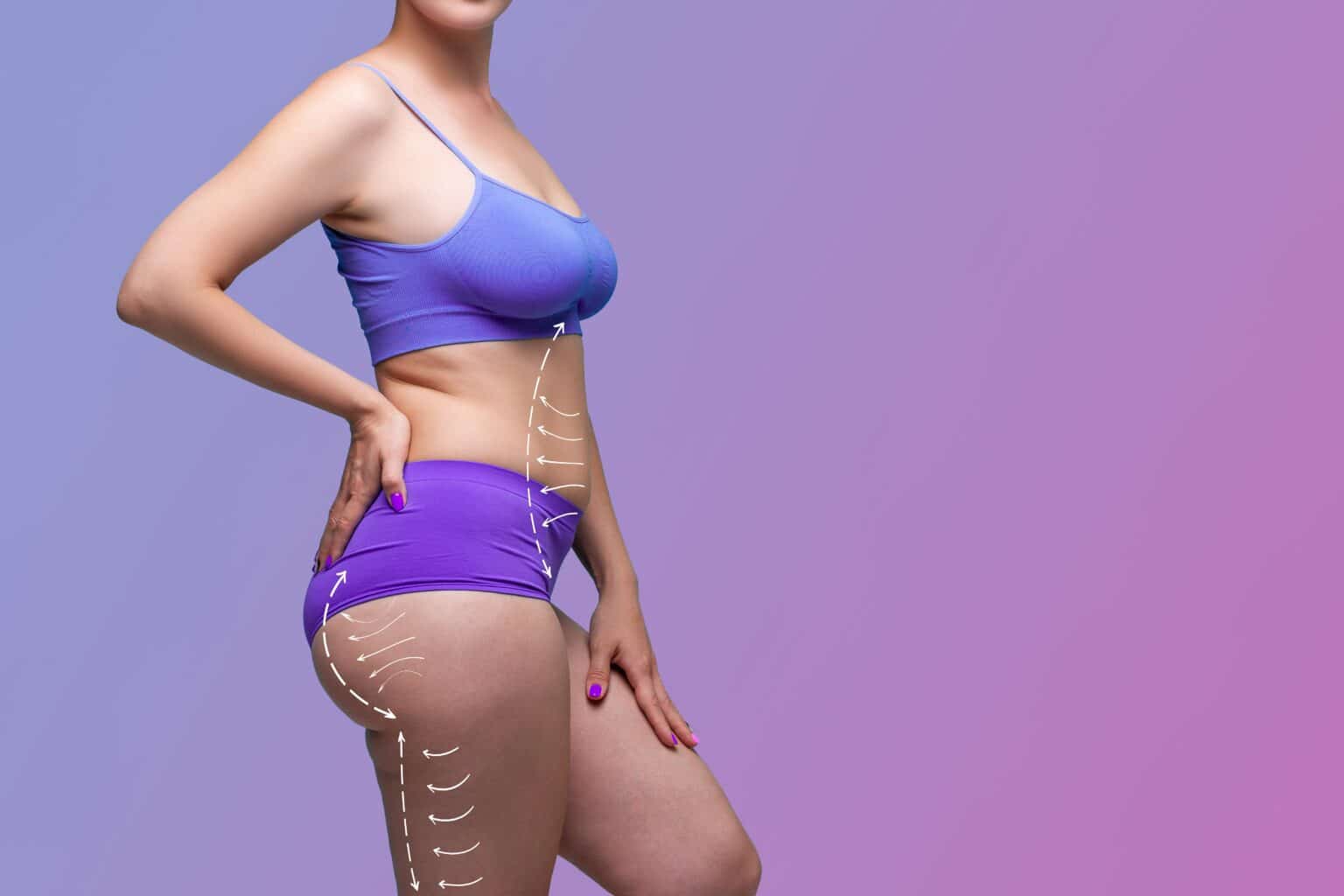 BodyTite vs Liposuction Key Differences