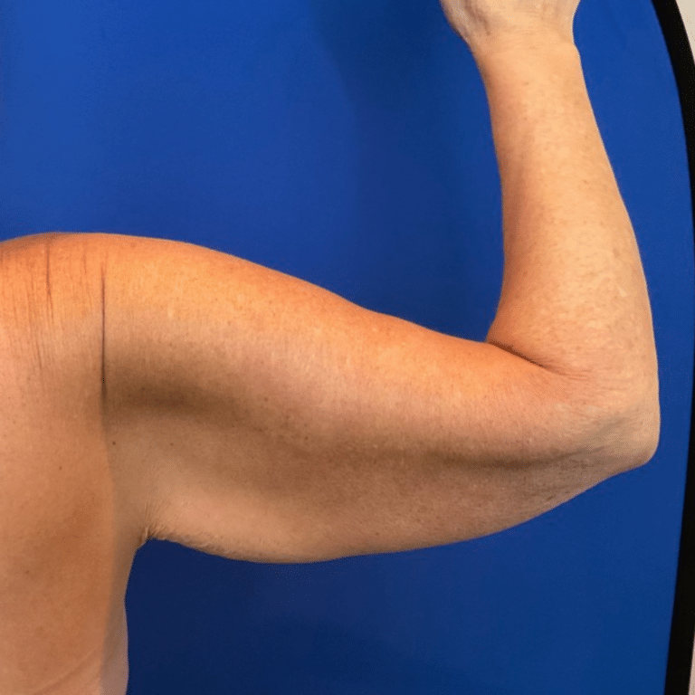 Before Image: Patient Case #6343 -