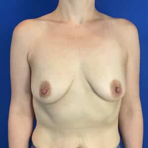 Before Image: Patient Case #6355
