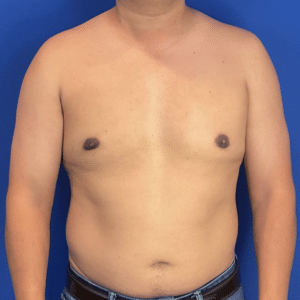 After Image: Patient Case #6432