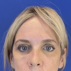 After Image: Patient Case #6820