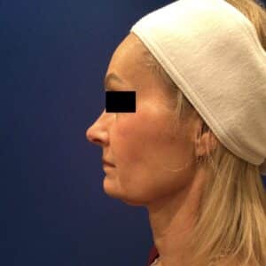 Before Image: Patient Case #6839