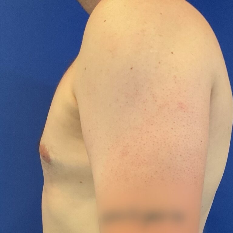 After Image: Patient Case #6754 - front