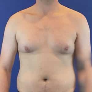 Before Image: Patient Case #6754