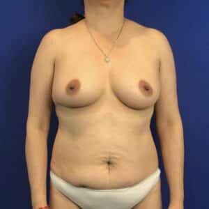 Before Image: Patient Case #6892