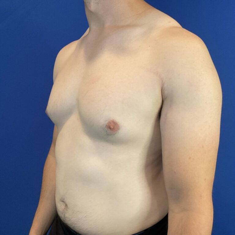 Before Image: Patient Case #6936 - left-front-oblique