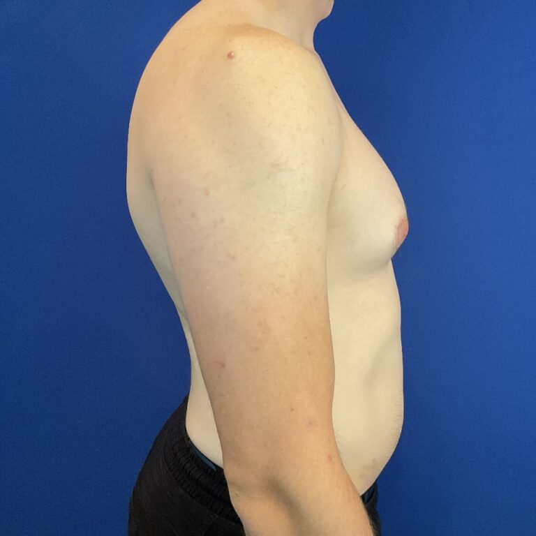 Before Image: Patient Case #6936 - right-side