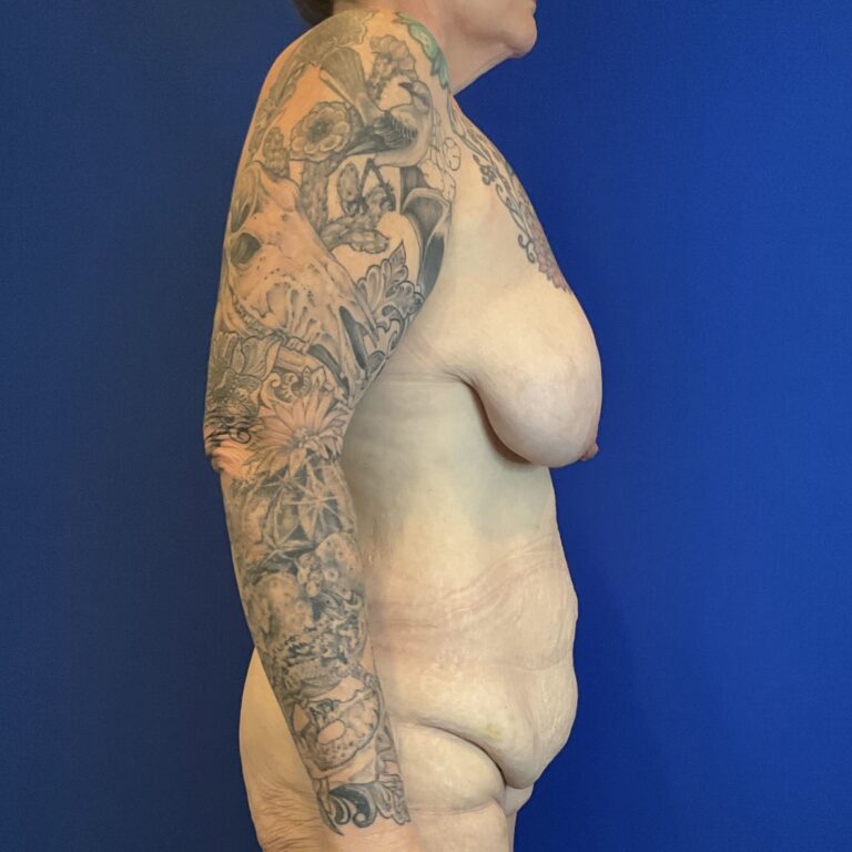 Before Image: Patient Case #6992 - right-side