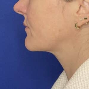 After Image: Patient Case #7016