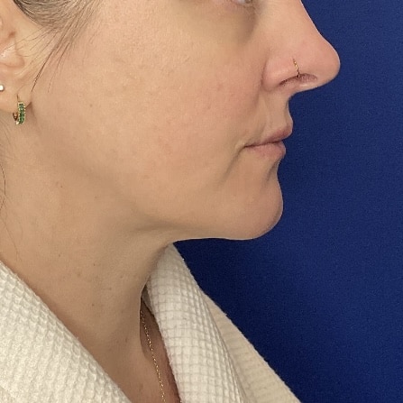 After Image: Patient Case #7016 -