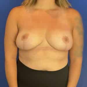 After Image: Patient Case #7033