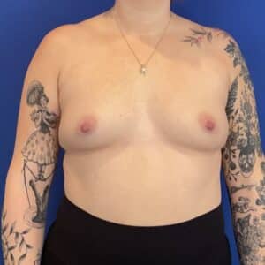 Before Image: Patient Case #7040