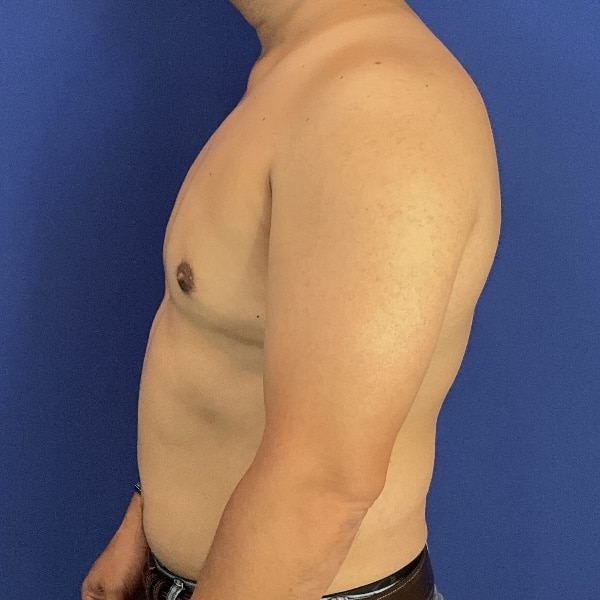 After Image: Patient Case #7061 -