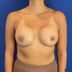 After Image: Patient Case #7090