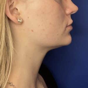 After Image: Patient Case #7140