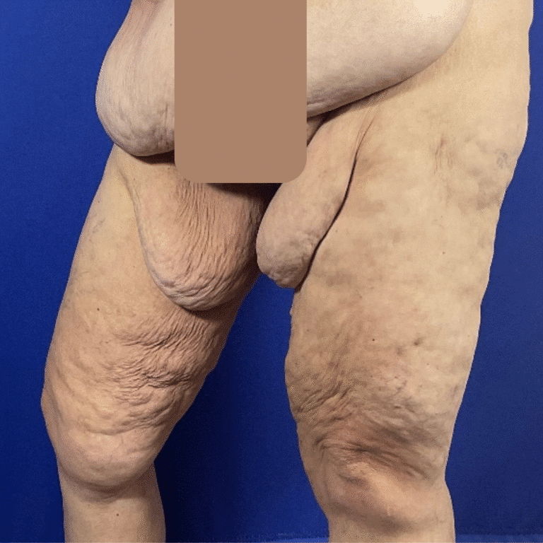 Before Image: Patient Case #7184 - left-front-oblique